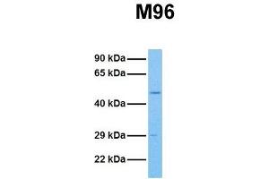 Host:  Rabbit  Target Name:  M96  Sample Tissue:  Human HCT116  Antibody Dilution:  1. (MTF2 Antikörper  (Middle Region))
