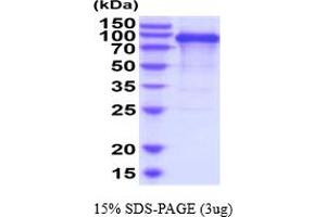 SDS-PAGE (SDS) image for CUB Domain Containing Protein 1 (CDCP1) (AA 30-667) protein (His tag) (ABIN7529314) (CDCP1 Protein (AA 30-667) (His tag))