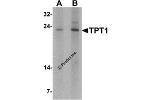 Western Blotting (WB) image for anti-Tumor Protein, Translationally-Controlled 1 (TPT1) antibody (ABIN1077430)