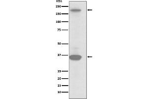 Western blot analysis of RON expression in SKBR3 cell lysate.