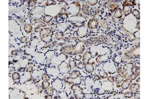 Immunoperoxidase of monoclonal antibody to STX18 on formalin-fixed paraffin-embedded human salivary gland. (Syntaxin 18 Antikörper  (AA 101-199))