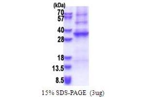 SDS-PAGE (SDS) image for Adenosine Deaminase-Like Protein (ADAL) (AA 1-267) protein (His tag) (ABIN5853646) (ADAL Protein (AA 1-267) (His tag))