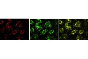 Immunofluorescence (IF) image for anti-Vesicle-Associated Membrane Protein 7 (VAMP7) antibody (ABIN1109463) (VAMP7 Antikörper)