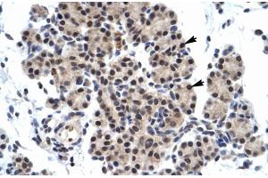 Human Pancreas (ZNF318 Antikörper  (N-Term))