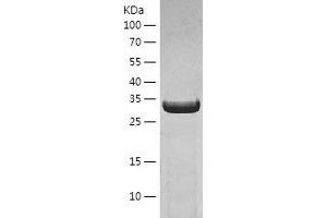 Western Blotting (WB) image for Pyrophosphatase 2 (PPA2) (AA 33-334) protein (His tag) (ABIN7124716)