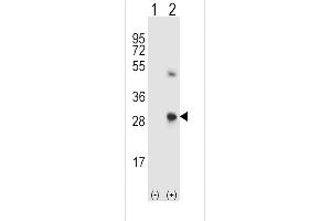 Western blot analysis of SPARC using rabbit polyclonal SPARC Antibody using 293 cell lysates (2 ug/lane) either nontransfected (Lane 1) or transiently transfected (Lane 2) with the SPARC gene. (SPARC Antikörper  (C-Term))