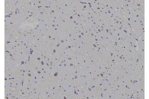 ABIN6269296 at 1/100 staining Human heart tissue by IHC-P. (14-3-3 zeta Antikörper  (C-Term))