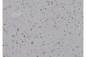 ABIN6269296 at 1/100 staining Human heart tissue by IHC-P.