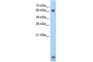 WB Suggested Anti-MBD1 Antibody Titration:  0. (MBD1 Antikörper  (C-Term))