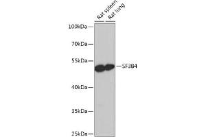 Western blot analysis of extracts of various cell lines, using SF3B4 antibody (ABIN7270545) at 1:1000 dilution.