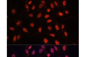 Immunofluorescence analysis of U-2 OS cells using Bcl-2 Polyclonal Antibody at dilution of 1:100 (40x lens). (Bcl-2 Antikörper)