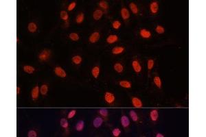 Immunofluorescence analysis of U-2 OS cells using Bcl-2 Polyclonal Antibody at dilution of 1:100 (40x lens). (Bcl-2 Antikörper)