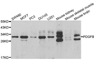 Western blot analysis of extracts of various cell lines, using PDGFB antibody (ABIN5970539) at 1/1000 dilution. (PDGFB Antikörper)