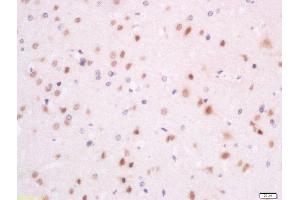 Formalin-fixed and paraffin embedded rat brain labeled with Anti-SFRS7/9G8 Polyclonal Antibody, Unconjugated  at 1:200 followed by conjugation to the secondary antibody and DAB staining (SFRS7 Antikörper  (AA 2-70))