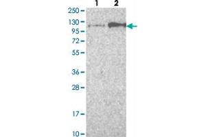 Western blot analysis of Lane 1: Negative control (vector only transfected HEK293T lysate) Lane 2: Over-expression lysate (Co-expressed with a C-terminal myc-DDK tag (~3. (FGFR4 Antikörper)