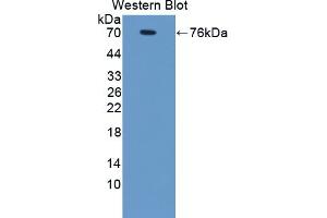 Western Blotting (WB) image for anti-Proteasome (Prosome, Macropain) 26S Subunit, Non-ATPase, 6 (PSMD6) (AA 1-389) antibody (ABIN7443659)