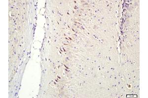 Paraformaldehyde-fixed, paraffin embedded Rat brain; Antigen retrieval by boiling in sodium citrate buffer (pH6. (CNIH2, CNIH3 (AA 25-120) Antikörper)
