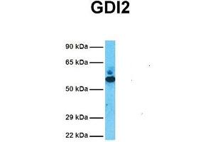 Host:  Rabbit  Target Name:  GDI2  Sample Tissue:  Human Fetal Lung  Antibody Dilution:  1. (GDI2 Antikörper  (C-Term))