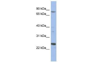 MARK3 antibody used at 1 ug/ml to detect target protein. (MARK3 Antikörper  (Middle Region))