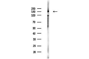 anti-Tenascin N (TNN) (C-Term) antibody
