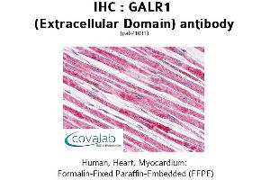 Image no. 2 for anti-Galanin Receptor 1 (GALR1) (2nd Extracellular Domain) antibody (ABIN1734566)
