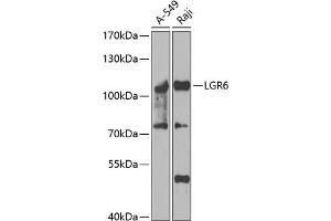 Western blot analysis of extracts of various cell lines, using LGR6 antibody (ABIN6130405, ABIN6143182, ABIN6143184 and ABIN6223245) at 1:1000 dilution. (LGR6 Antikörper  (AA 350-510))