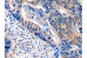 Immunohistochemistry (IHC) image for anti-Inducible T-Cell Co-Stimulator Ligand (ICOSLG) (AA 23-249) antibody (ABIN7439975)