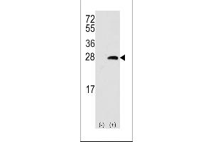 Western blot analysis of OPRS1 (arrow) using rabbit polyclonal OPRS1 Antibody (Center) (ABIN389222 and ABIN2839375).