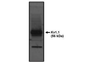 Image no. 1 for anti-Potassium Voltage-Gated Channel, Shaker-Related Subfamily, Member 1 (KCNA1) antibody (ABIN265021) (KCNA1 Antikörper)