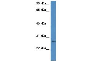 WB Suggested Anti-CMA1 Antibody Titration: 0. (CMA1 Antikörper  (C-Term))