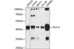 Western blot analysis of extracts of various cell lines, using HLA-E antibody (ABIN6133750, ABIN6141843, ABIN6141845 and ABIN6224489) at 1:1000 dilution.