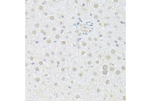 Immunohistochemistry of paraffin-embedded rat liver using AKT1 antibody (ABIN5997218) at dilution of 1/100 (40x lens). (AKT1 Antikörper)