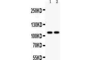 Anti- ATP2A1 antibody, Western blotting All lanes: Anti ATP2A1  at 0. (ATP2A1/SERCA1 Antikörper  (N-Term))