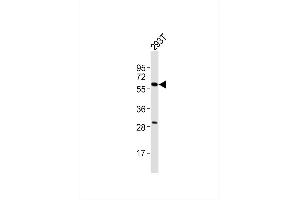 Western Blotting (WB) image for anti-Cytochrome P450, Family 3, Subfamily A, Polypeptide 7 (CYP3A7) antibody (ABIN6241634)