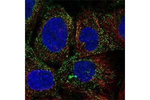 Immunofluorescent staining of A-431 cell line with antibody shows positivity in vesicles (green). (PDGFD Antikörper)