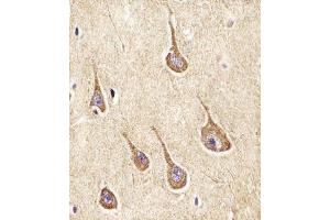 (ABIN6242948 and ABIN6577962) staining NPY2R in Human brain tissue sections by Immunohistochemistry (IHC-P - paraformaldehyde-fixed, paraffin-embedded sections). (NPY2R Antikörper  (N-Term))