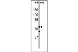 Western Blotting (WB) image for anti-Autophagy related 4D Cysteine Peptidase (ATG4D) (AA 227-257) antibody (ABIN1449634)