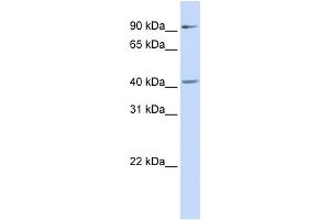 WB Suggested Anti-SOX17 Antibody Titration:  0. (SOX17 Antikörper  (Middle Region))