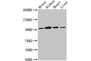 Western Blot Positive WB detected in: Rat brain tissue, Rat kidney tissue, Mouse heart tissue, Mouse liver tissue All lanes: NAA15 antibody at 3 μg/mL Secondary Goat polyclonal to rabbit IgG at 1/50000 dilution Predicted band size: 102, 62 kDa Observed band size: 95 kDa (NAA15 Antikörper  (AA 742-865))