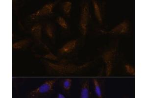 Immunofluorescence analysis of U-2 OS cells using SLC25A27 Polyclonal Antibody at dilution of 1:100. (SLC25A27 Antikörper)