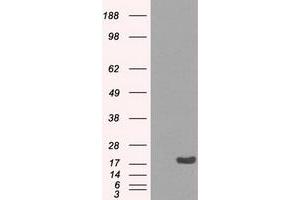 Image no. 2 for anti-Crystallin, alpha B (CRYAB) antibody (ABIN1497641) (CRYAB Antikörper)