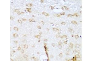 Immunohistochemistry (Paraffin-embedded Sections) (IHC (p)) image for anti-Ubiquitin-Conjugating Enzyme E2L 3 (UBE2L3) antibody (ABIN7260980)