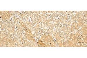 Immunohistochemistry of paraffin-embedded Human brain tissue using TXNDC12 Polyclonal Antibody at dilution of 1:50(x200) (TXNDC12 Antikörper)