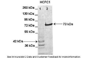 Lanes:   Lane1: HIS-HCFC1 16-363aa (42kD) transformed bacteria lysate Lane2: GFP-HCFC1 363-2002aa (73kD) transformed bacteria lysate elution sample  Primary Antibody Dilution:   1:1000  Secondary Antibody:   Anti-rabbit AlexaFluor 680  Secondary Antibody Dilution:   1:10000  Gene Name:   HCFC1  Submitted by:   Anonymous (HCFC1 Antikörper  (Middle Region))