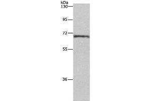 Western Blot analysis of Human normal liver tissue using HSF27 Polyclonal Antibody at dilution of 1:655 (CDK5RAP3 Antikörper)