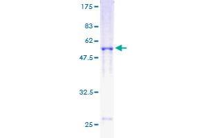 Image no. 1 for DNA Repair Protein Homolog 1 (RAD51) (AA 1-242) protein (GST tag) (ABIN1317281)