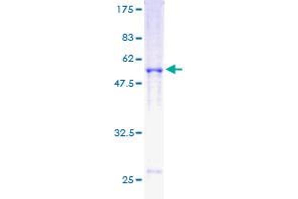 RAD51 Protein (AA 1-242) (GST tag)