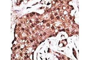 Immunohistochemistry (IHC) image for anti-ATG5 Autophagy Related 5 (ATG5) (AA 1-30) antibody (ABIN3030038)