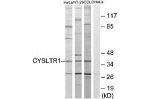 Western blot analysis of extracts from COLO205/HT-29/HeLa cells, using CYSLTR1 Antibody. (CysLTR1 Antikörper  (AA 131-180))