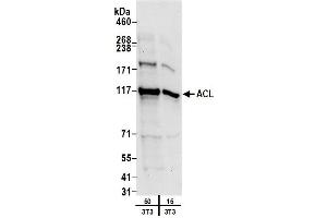 Western Blotting (WB) image for anti-ATP Citrate Lyase (ACLY) (AA 1051-1101) antibody (ABIN7452922)
